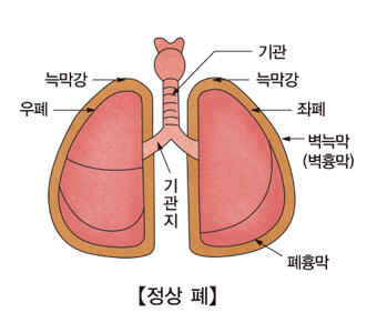 기관 늑막강 좌폐 벽늑막(벽흉만) 폐흉막 기관지 우폐 늑막강을 표시한 정상적인 폐의 모습