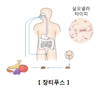 장티푸스에 감염되는 과정과 살모넬라타이피 세균의모습