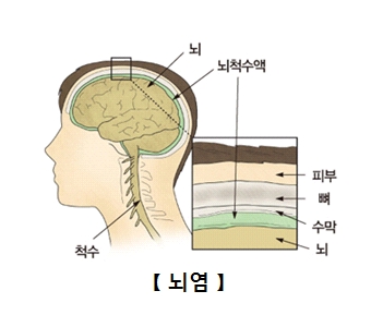 뇌 뇌척수액 척수의위치및 두피안의 피부,뼈,수막,뇌의 위치