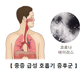 식도에서간까지의장기그림과 코로나바이러스