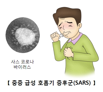 사스코로나바이러스와 기침을하며 괴로워하는 남성