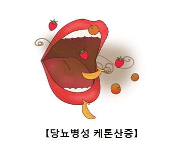 당뇨병성 케톤산증 그림 예시