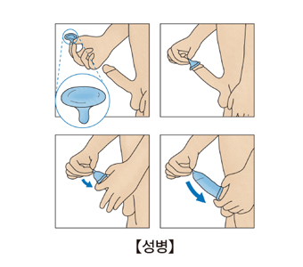 남성 콤돔사용방법