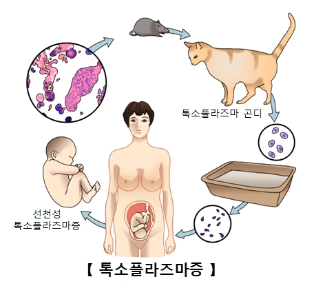 톡소플라즈마곤디에감염된쥐를통해 먹이사슬로 관계로 인간에게 감염시키는순환과정