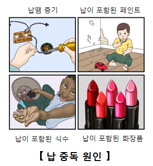 납 중독의 원인 납땜증기,납이포함된페인트,납이포함된식수,납이포함된화장품