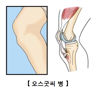 무릎부분의 근육과뼈의 해부도예시