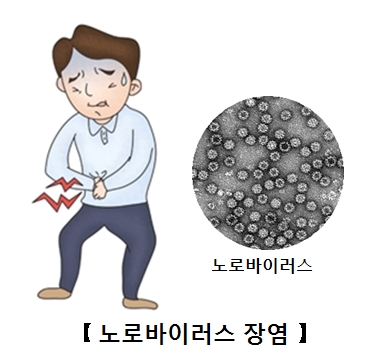 복통을 호소하는남성과 노로바이러스 현미경사진