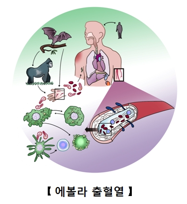 에볼라바이러스에걸리게되는과정과 걸린후 혈관의모습