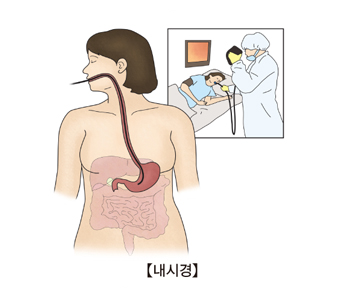 내시경시술의 예