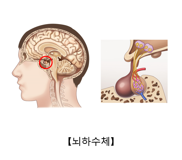 뇌하수체기능저하증이란 무엇인가요?