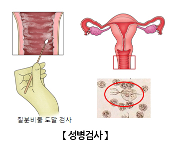 성병검사