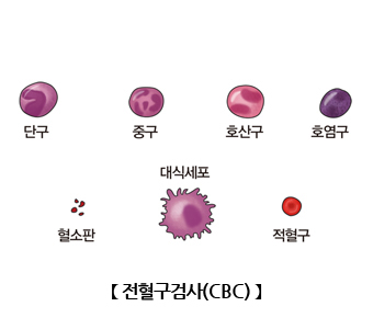 전혈구검사