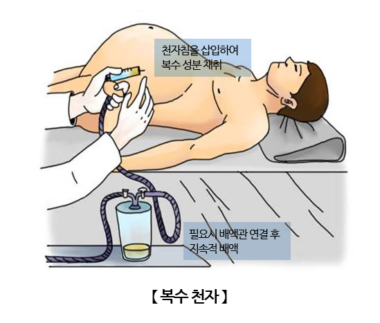 복수 천자