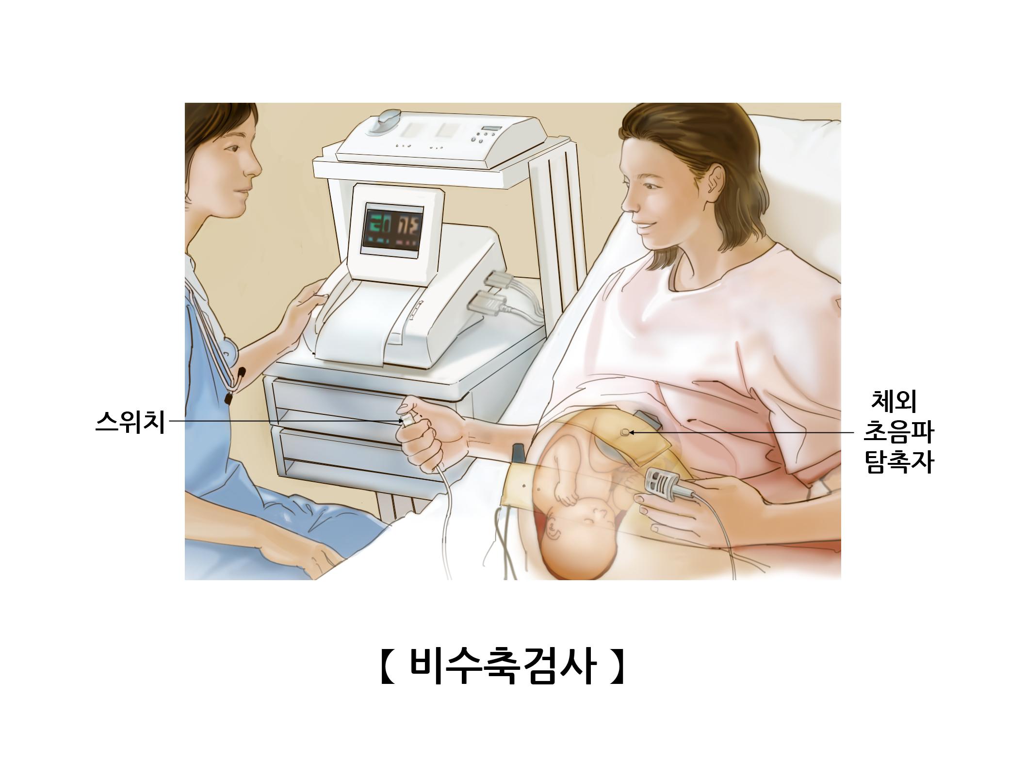 비수축검사