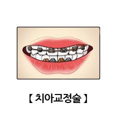 치아교정술