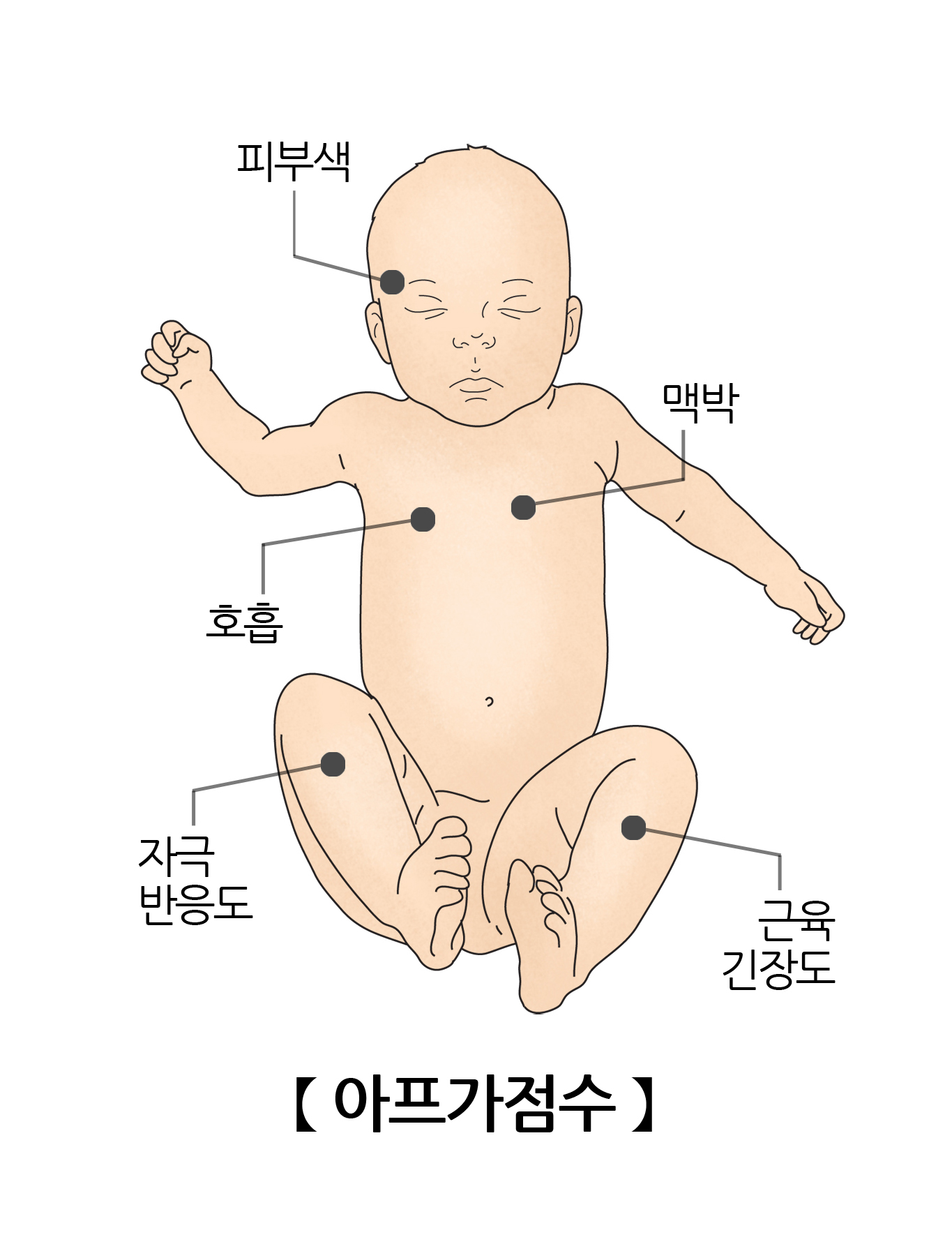 아프가 점수