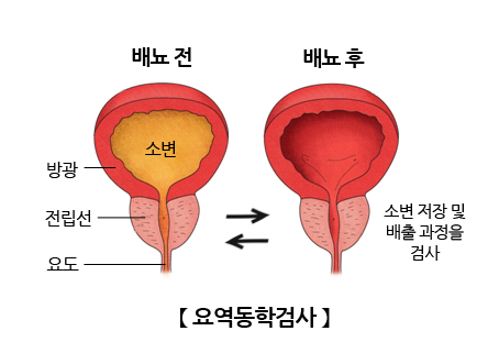 요역동학검사