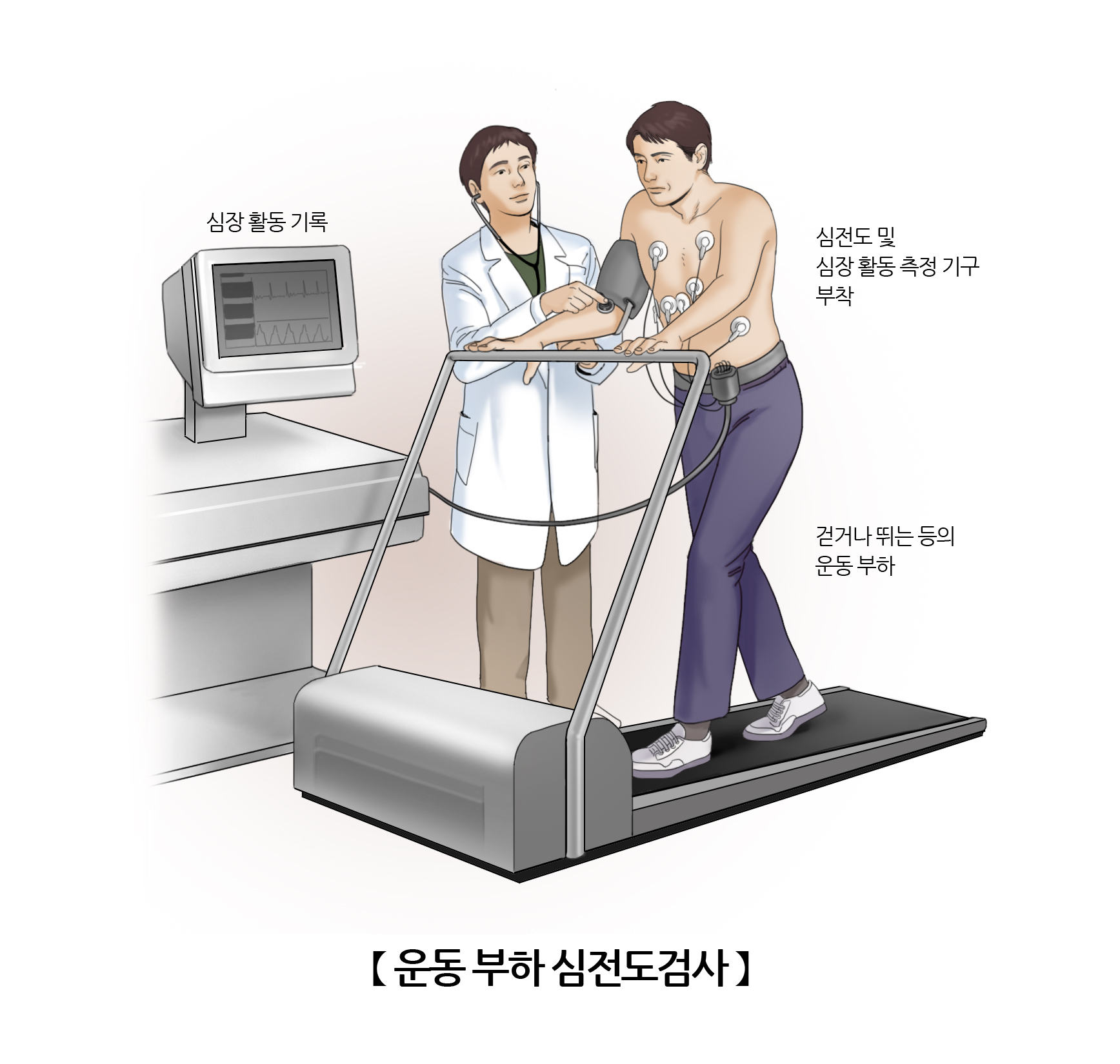 운동 부하 심전도 검사