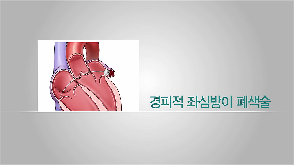 대표이미지 썸네일