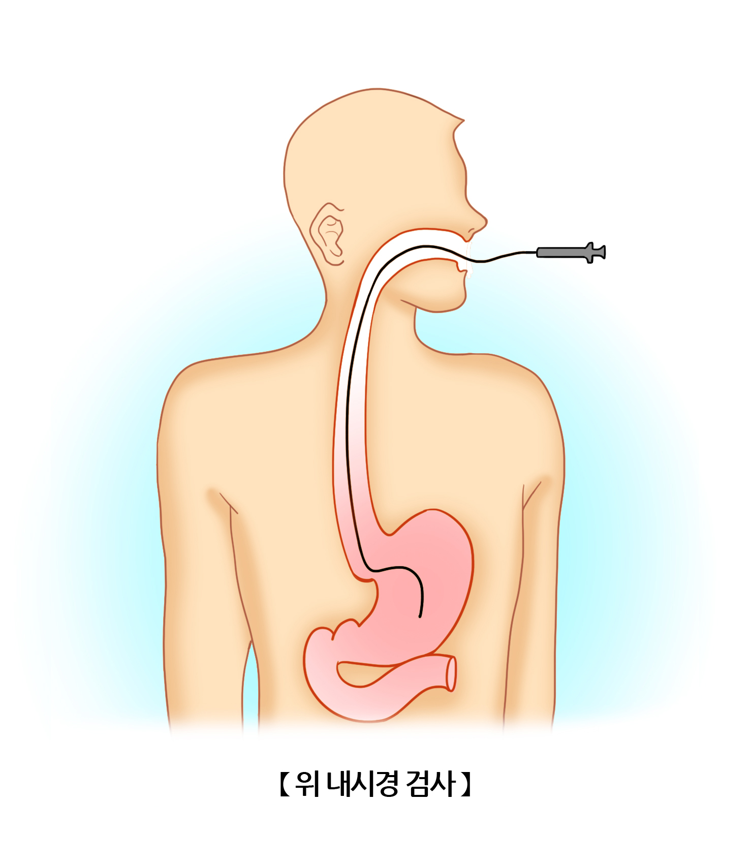 위 내시경검사 | 검사/시술/수술 정보 | 의료정보 | 건강정보 | 서울아산병원