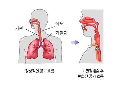 기관 | 인체정보 | 의료정보 | 건강정보 | 서울아산병원 기관 | 인체정보 | 의료정보 | 건강정보 | 서울아산병원