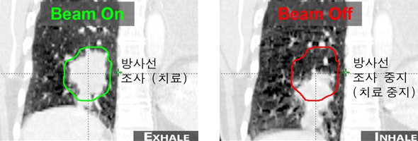 방사선 조사 중 이미지