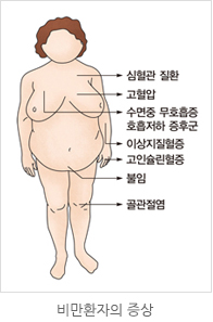 비만 환자의 증상 이미지