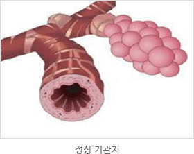 정상기관지 모습