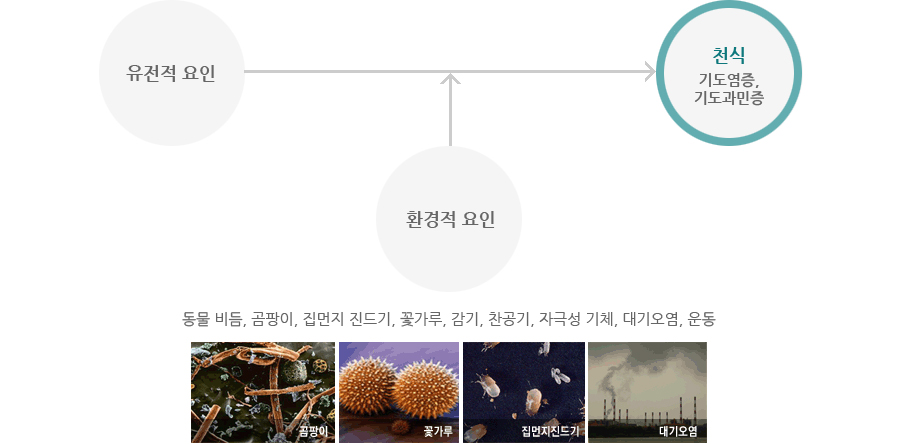 기관지천식의원인 도식, 하단 설명 참조