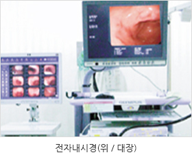 전자내시경 사진