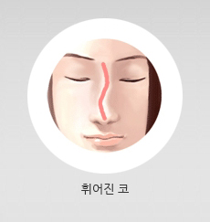 코가 오른쪽으로 휜 여성의 그림