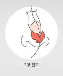 코가 S형으로 휜 코 입니다.