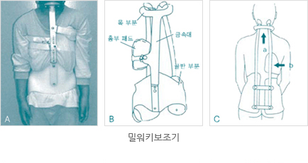 밀워키 보조기 사진