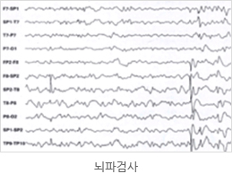 뇌파검사 이미지 입니다