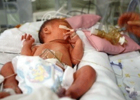 서울아산병원 신생아과 병실에서 아기가 인큐베이터에서 치료받고 있는 모습