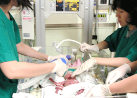 서울아산병원 신생아과 병실에서 폐표면활성제(surfactant) 치료를 하는 모습