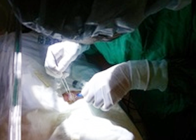 수서울아산병원 신생아과 수술실에서 한 의료진이 중심정맥관 삽입술을 시술 하는 모습