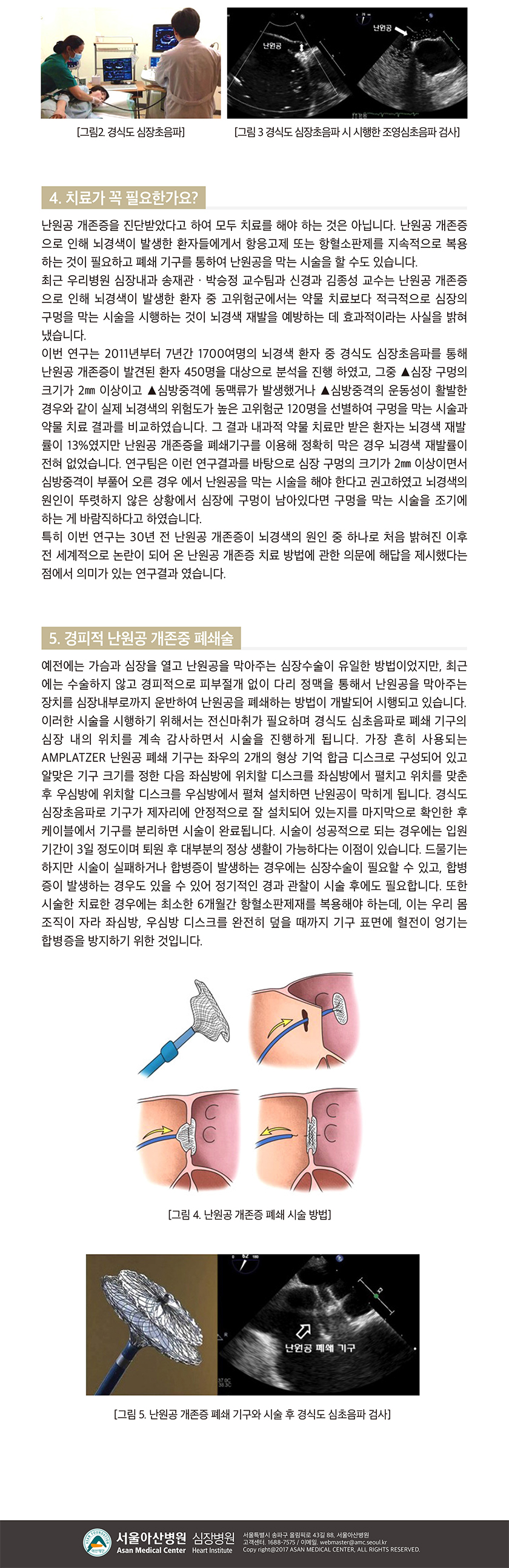 [아산심장소식지 2018년 가을호] 난원공개존증