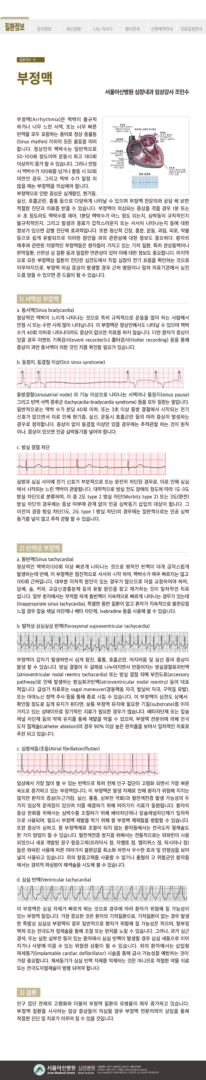 [아산심장소식지 2017년 겨울호] 부정맥