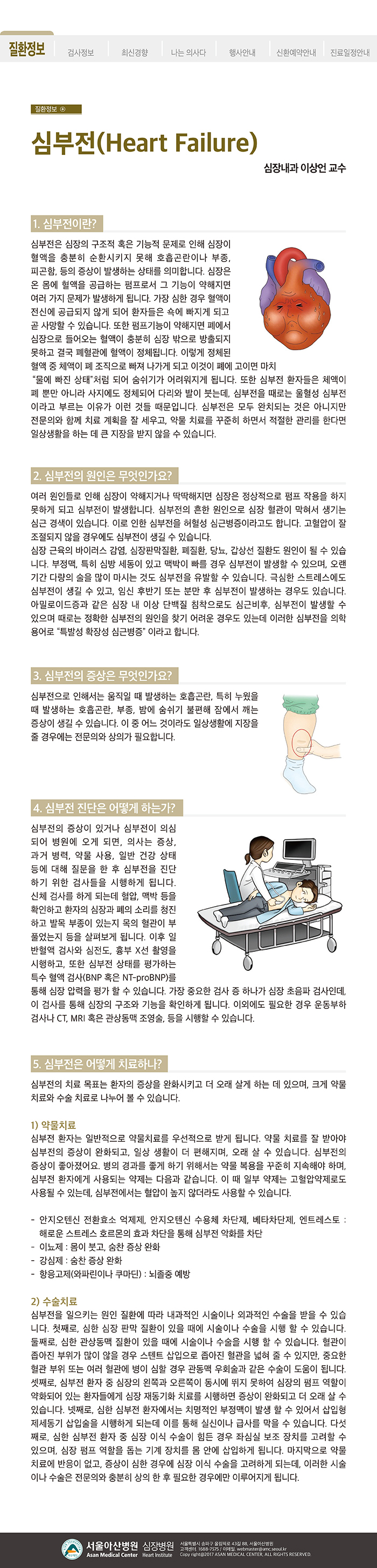 [아산심장소식지 2018년 봄호] 심부전