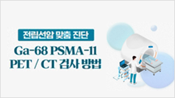 전립선암 맞춤진단용 Ga 68 PSMA 11 PET CT 검사