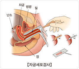 자궁경부세포