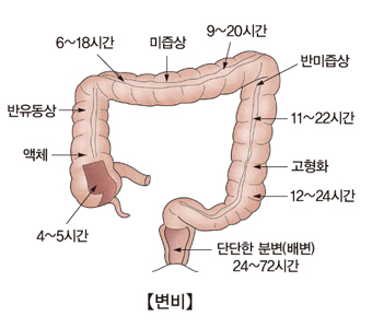 변비원인 및 배변